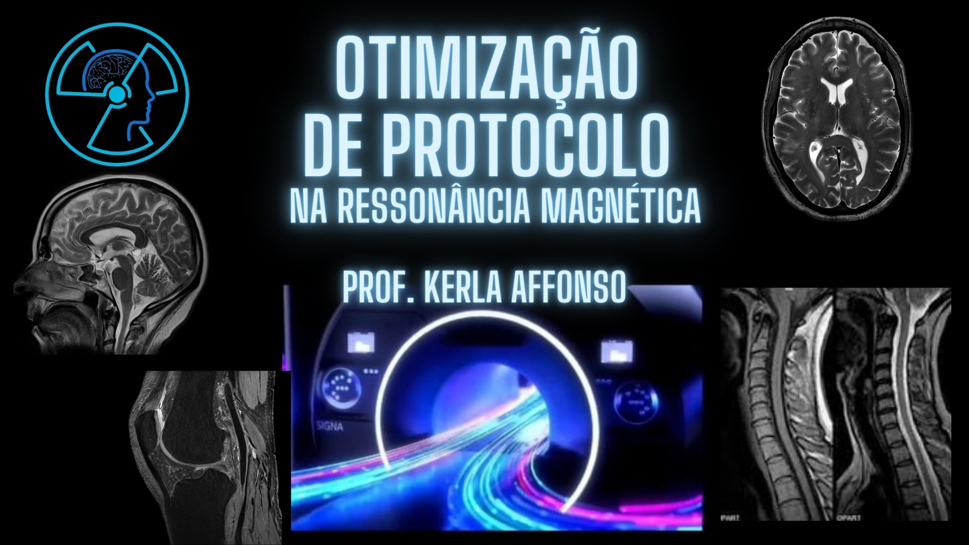 otimiz