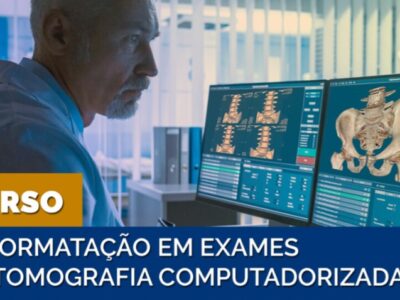 Curso de Reformatação em Tomografia Computadorizada